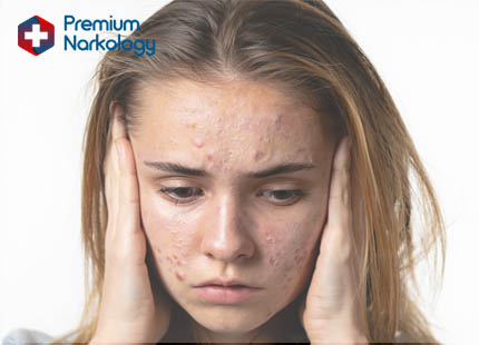 Признаки наркотического опьянения Девушка под действием наркотиков